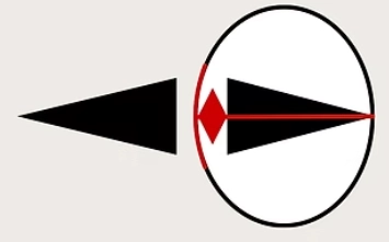 Diagram comparing light pathways through an eye-shaped outline with lens elements and focal points.